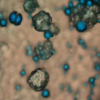 L'olio (in blu) contiene un marcatore tracciabile con ecografia e TAC per consentire ai medici di seguire le microcapsule (in marrone) durante la veicolazione alla massa tumorale. La pelle esterna semipermeabile ha la capacità fisica di rilasciare il farmaco lentamente.