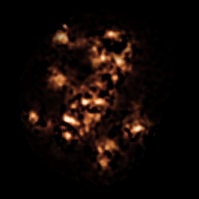 Questa immagine mostra la veduta presa da APEX in luce submillimetrica della regione che circonda la galassia Tela di Ragno, un proto-ammasso di galassie dell'Universo primordiale intorno a una radiogalassia che contiene un buco nero supermassiccio. Alcune delle macchie di questa immagine corrispondono a galassie con alta formazione stellare nel protoammasso e non sono visibili nella banda ottica a causa dell'assorbimento dovuto alla polvere. I dettagli più deboli sono causati da artefatti della complessa procedura di elaborazione delle immagini di APEX. Crediti: ESO