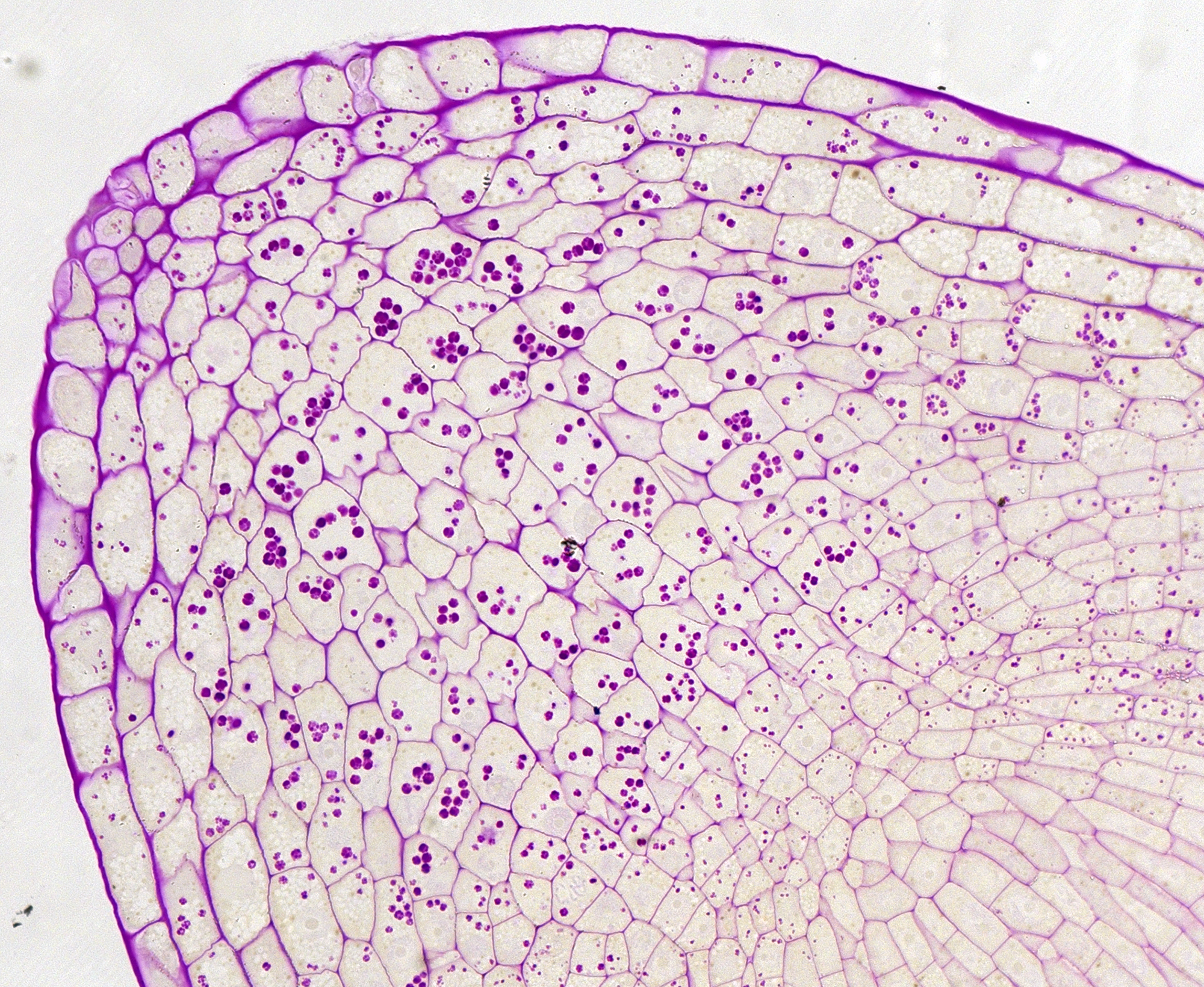 Какой микропрепарат изображен на рисунке. Микропрепарат ткани растений. Корневой чехлик под микроскопом. Корневой чехлик микропрепарат. Меристема микрофотография.