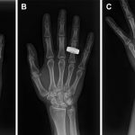 Radiografie nello spazio, ora si può